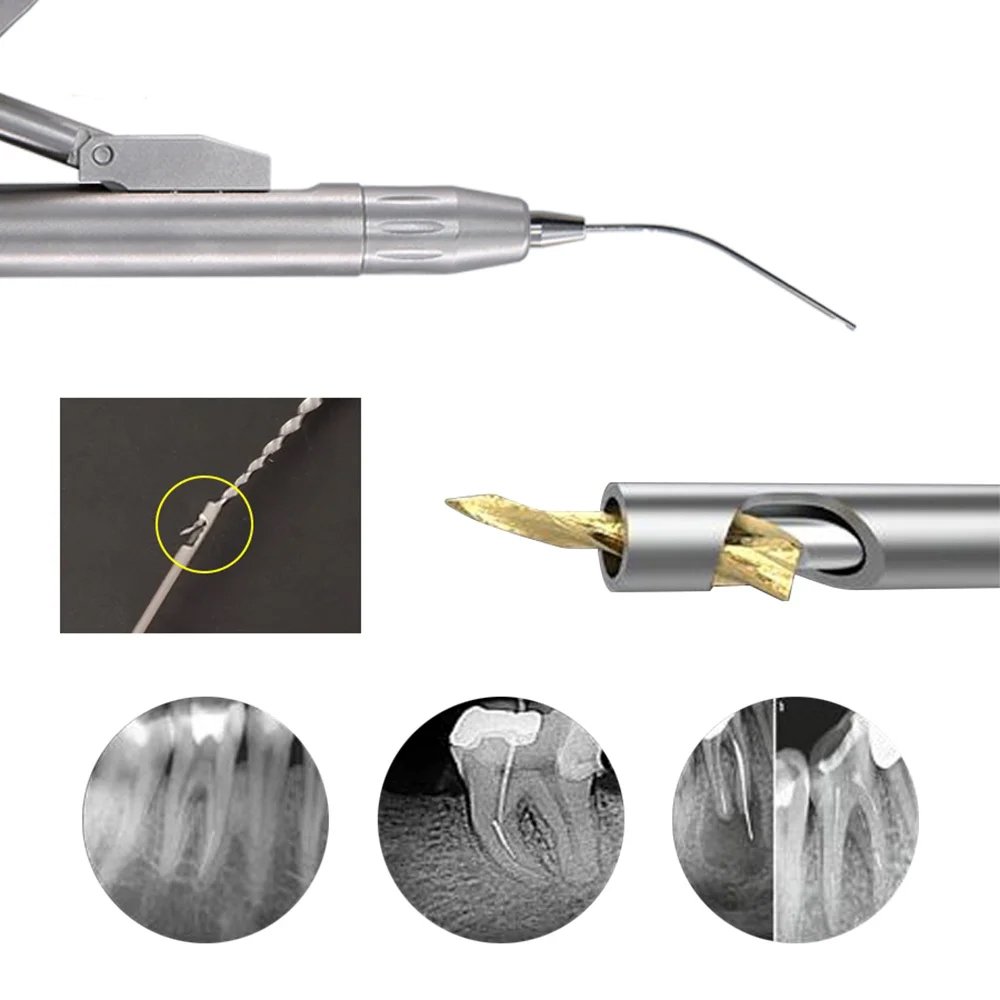 Endodontic File Removal System ANYWAY